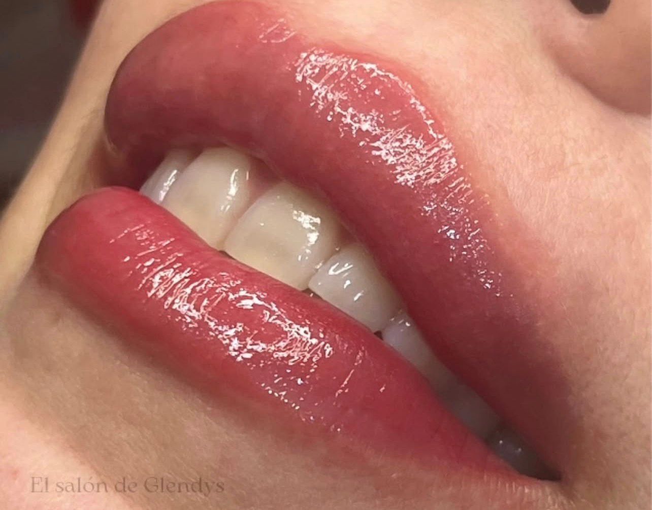 Resultado real de micropigmentación de labios
