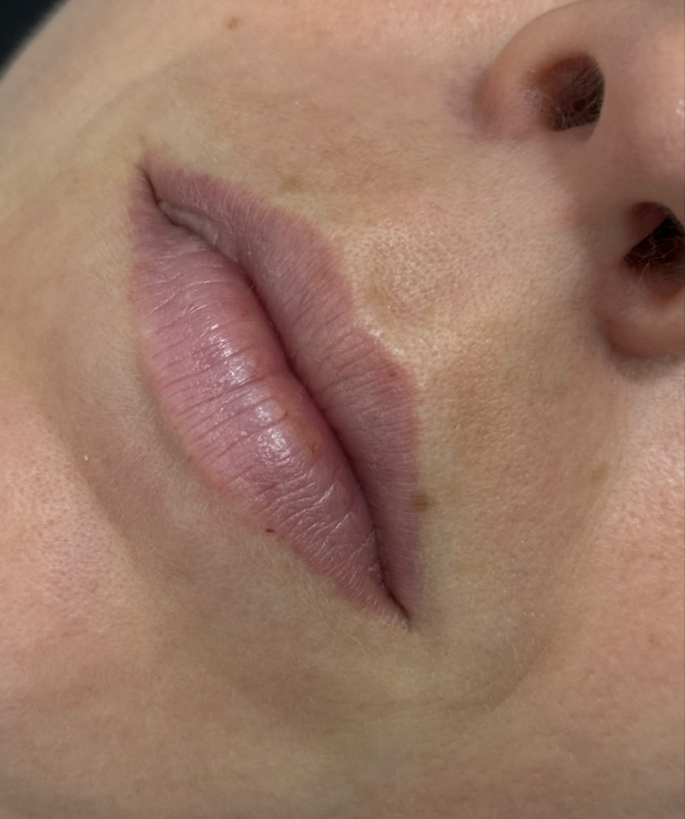 Labios antes de la micropigmentación